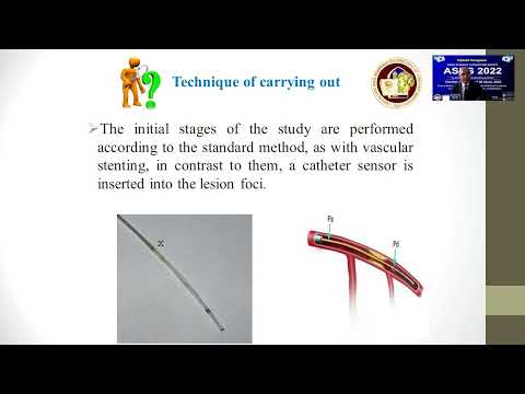 Intravascular ultrasound IVUS