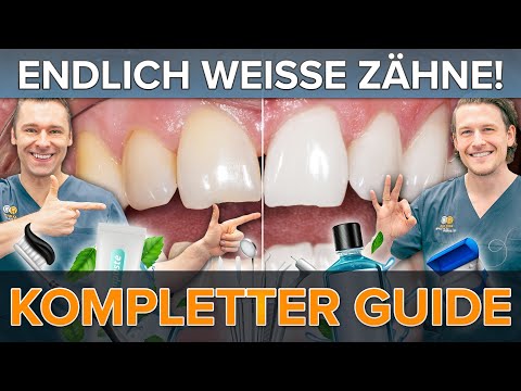 Endlich SCHÖNE & HELLE ZÄHNE 😁 - So kannst du Deine Zähne aufhellen - unser kompletter Guide!