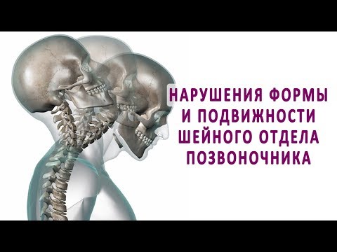 Тяжесть и боль в затылке при остеохондрозе Болит поясница бассейн