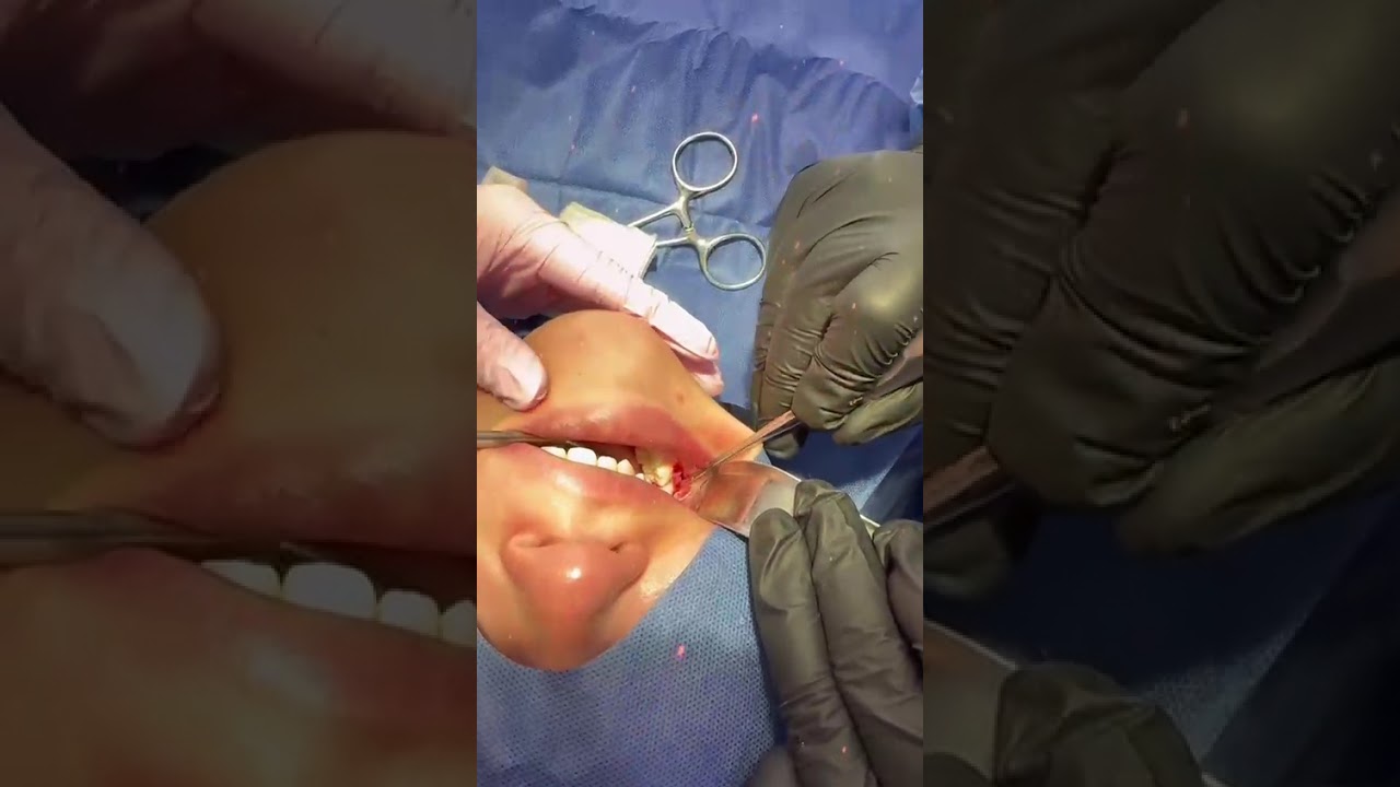 Alejandro Daniel Montiel Garcés-5