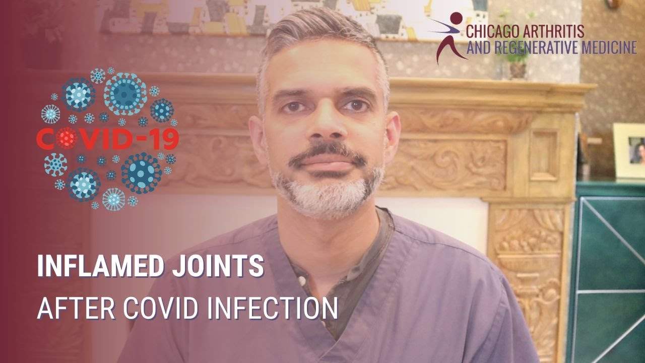 Inflamed Joints After COVID Infection img