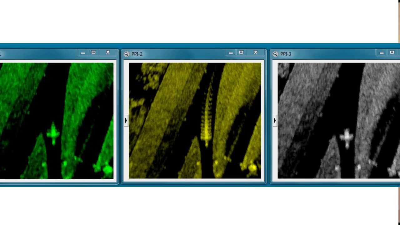 SkyRadar Drone Detection