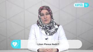 Liken Planus Nedir?