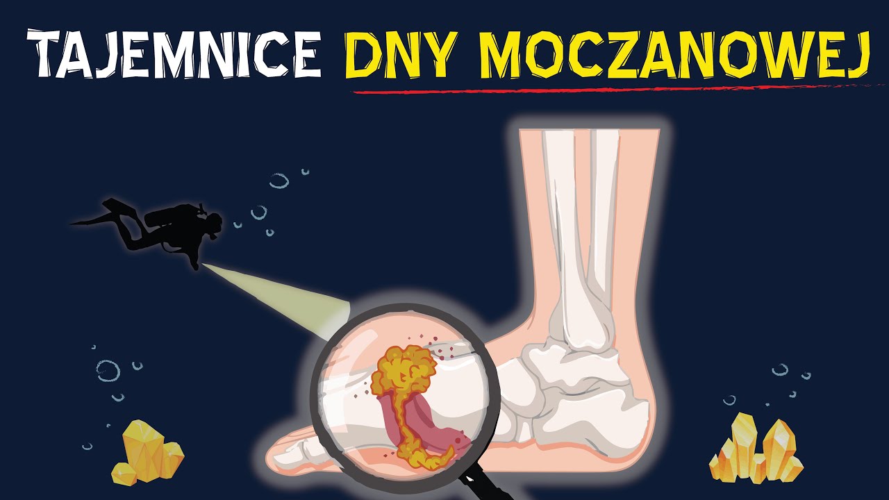 KWAS MOCZOWY a dna moczanowa i bóle stawów — skąd się biorą i jak im zapobiegać?