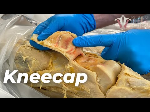 Why You Have a Kneecap and How it Unleashes Your Quads