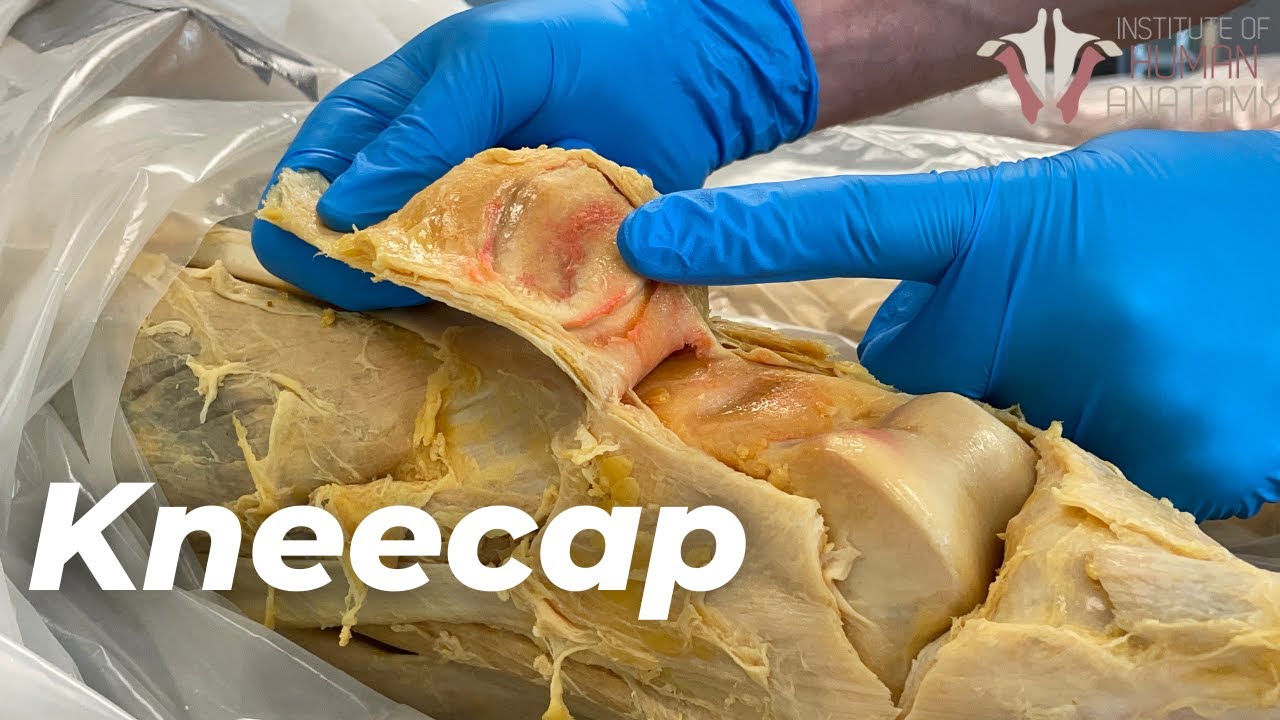 Why You Have a Kneecap and How it Unleashes Your Quads