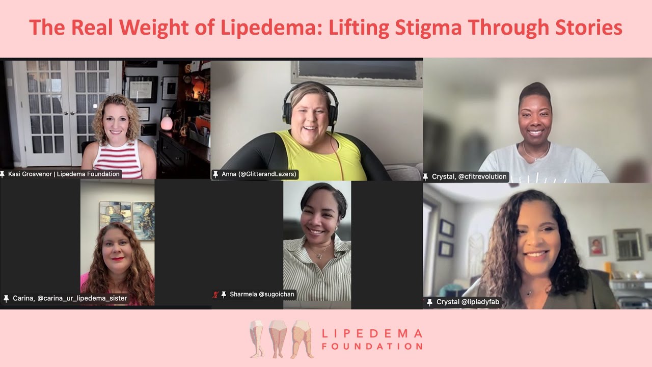 The Real Weight of Lipedema: Lifting Stigma Through Stories