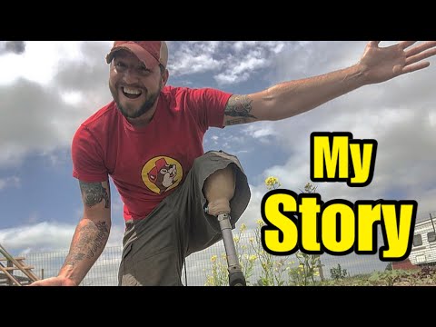 How I Lost My Leg