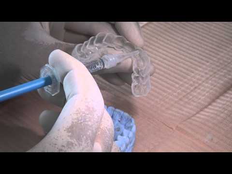 Home bleaching technique instructions