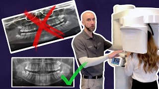 Tips For Optimal CBCT Scans