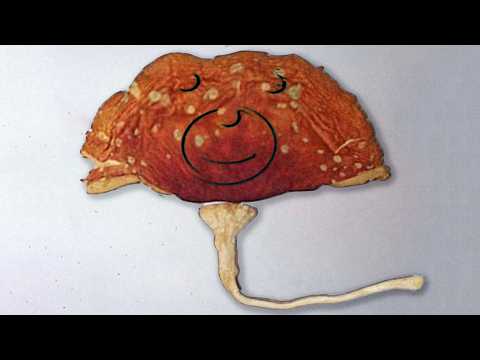 A Man Ate Forest-Picked Mushrooms And It Did Things To His Organs