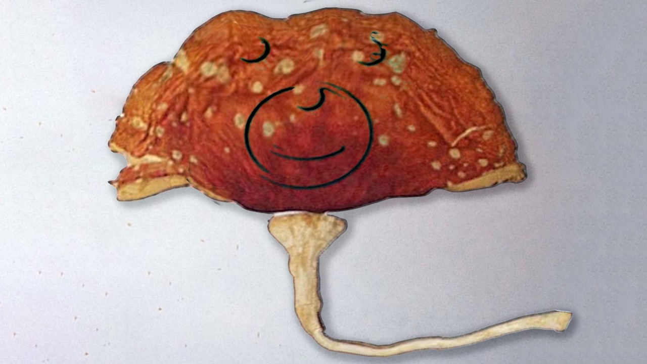 A Man Macrodosed Toxic Mushrooms And It Ruined His Life