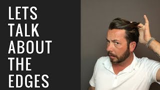 Hair Replacement Mens Hair System Review Lets Talk Edges?