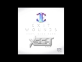 James Egbert ft. Nina Sung - Exit Wounds (X5IGHT ...