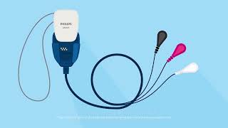 Philips Extended Holter – ePatch Lead wire adapter patient education video