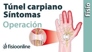 Túnel carpiano - Por qué sigo con síntomas después de operarme