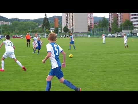 ČLŽ U12: FK Jablonec - FC Slovan Liberec 6:3 (6. díl)