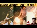 Funny Fire Accident Diwali Crackers Fireworks Diwali Incident Cracker Funny Video Tamil