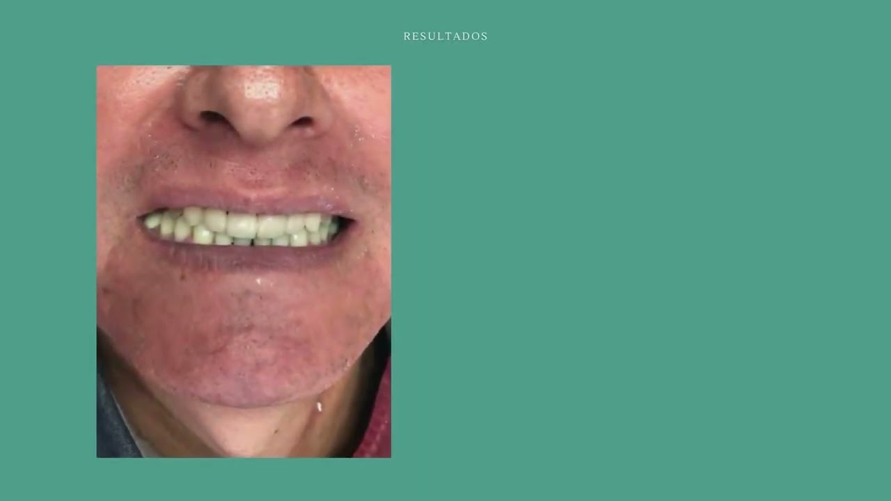 Arturo Romero Grande-41