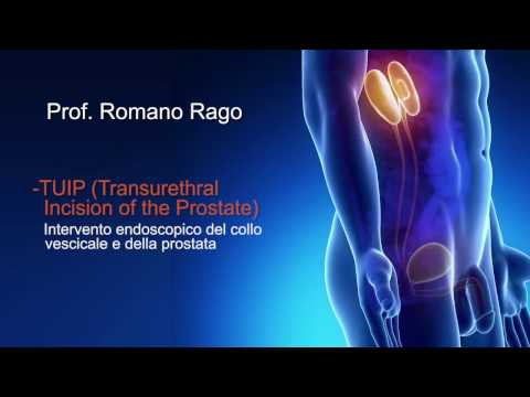 Prevenzione della prostata La rimozione della prostata