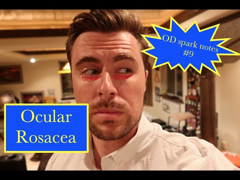 Optometry Spark notes #9 - ocular rosacea