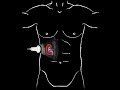 POCUS Basic Renal Ultrasound
