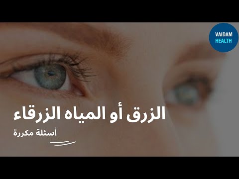 الأسئلة المتداولة حول الجلوكوما
