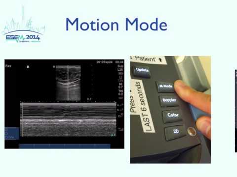 Introduction to ultrasound physics and knobology