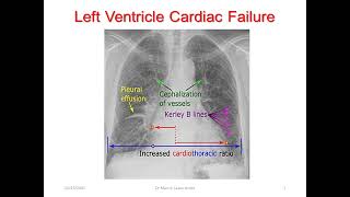 Dr Manny Learn shop Part 1 Common critical conditions in ICU