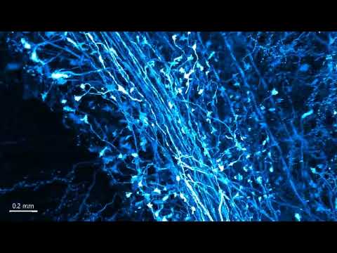 2022 09 11 125L 3d cerebellum