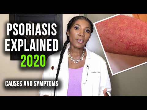 Psoriasis medication list