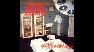 Dead Infection - Surgical Disembowelment -14- Flying Shit in the Outer Space