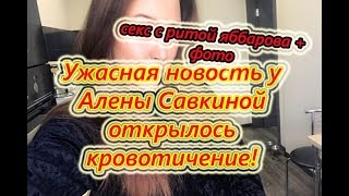 Самые Свежие Новости Дома 2 на 29.08.2018 У савкиной походу выкидыш?увезли с кровотечением