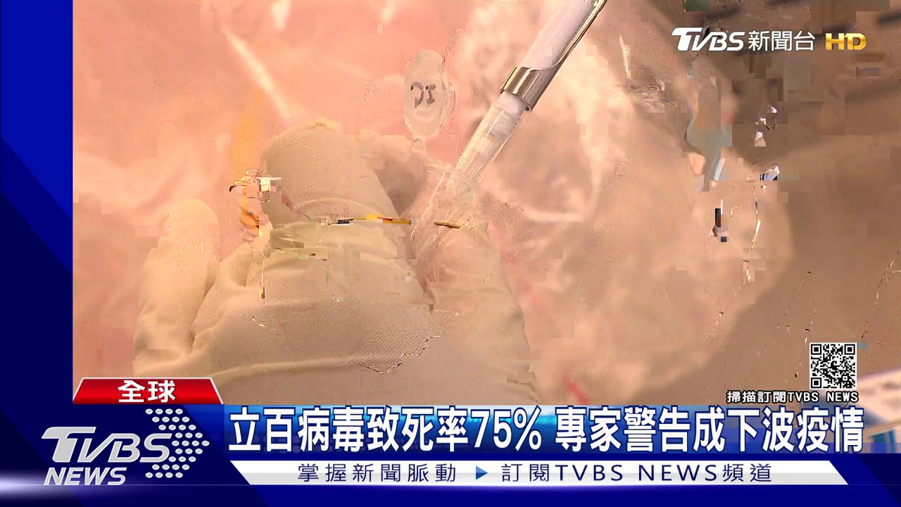 立百病毒致死率75% 專家警告成下波疫情
