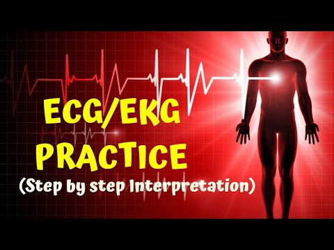 HOW TO READ AN ECG in 10 mins (part-2) ! | ECG / EKG PRACTICE