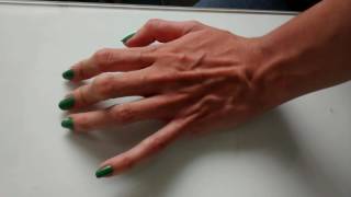 Veiny veins