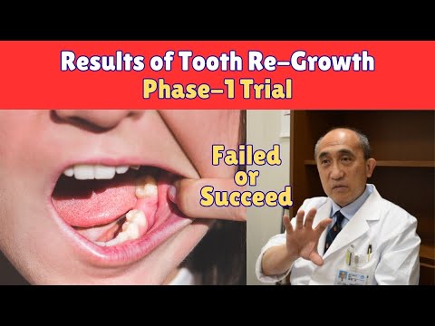Results of Tooth-Growth Phase-1 | Medical Miracle