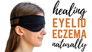 Healing Eyelid Eczema Naturally + Eyelid Atopic Dermatitis Triggers