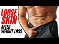 Dealing with LOOSE Skin After Weight Loss ft Bodybuilder Lee Hayward