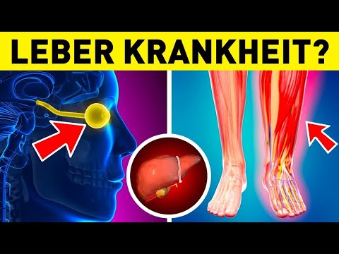 Die 10 häufigsten Frühwarnzeichen einer Lebererkrankung