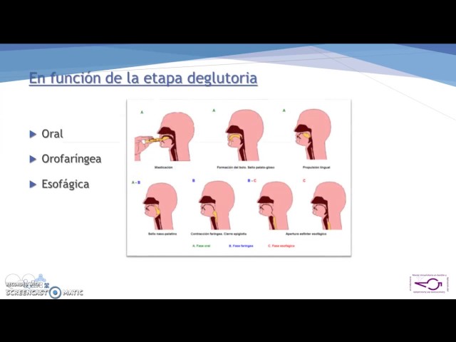 Vídeo relacionado con Rehabilitación de Problemas de Deglución en Pacientes con Daño Cerebral Sobrevenido: 4 (EOS Psicología)