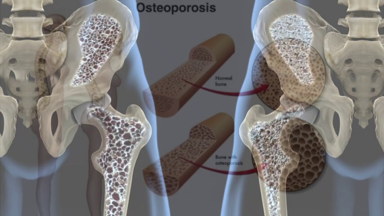 Carlos Alberto Alarcon Reyes-5