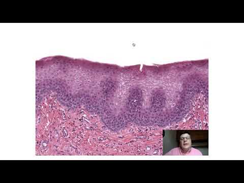 Tecido Epitelial de Revestimento