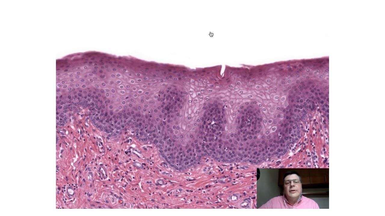 Tecido Epitelial de Revestimento