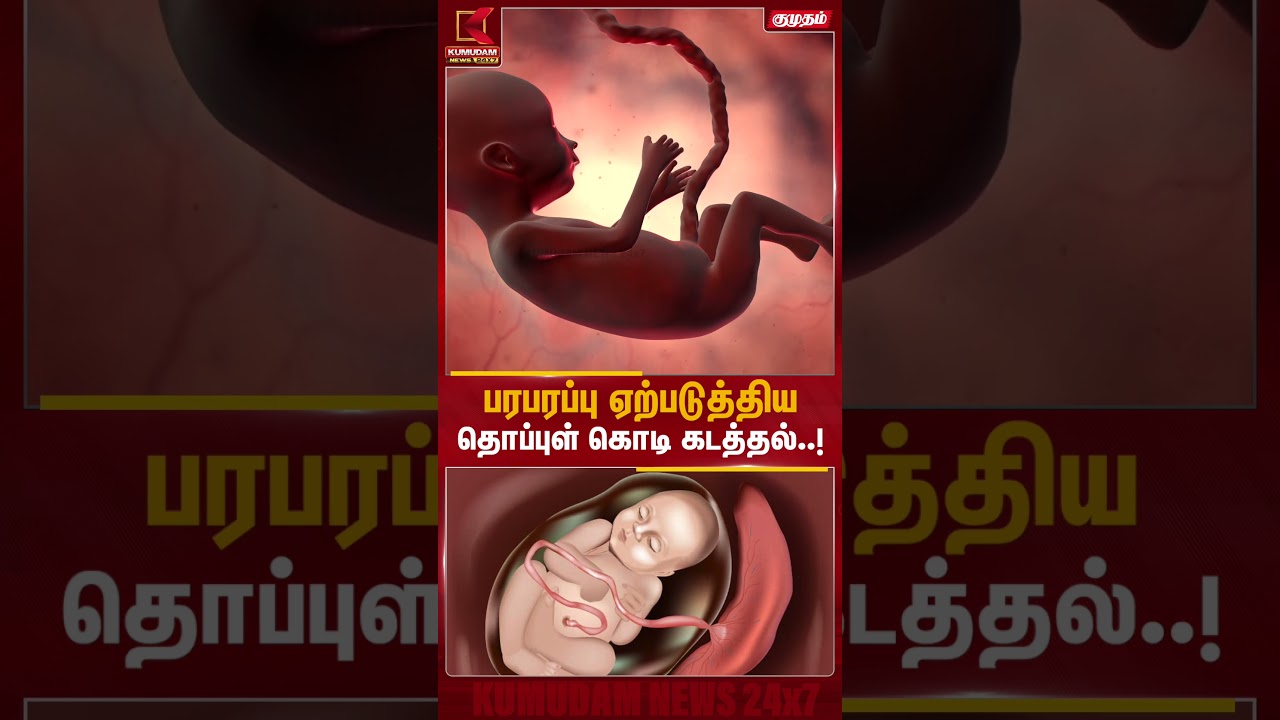 பரபரப்பு ஏற்படுத்திய தொப்புள் கொடி கடத்தல்..! Islamabad-தில் அதிர்ச்சி சம்பவம் | Kumudam News