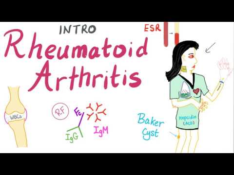 rheumatoid arthrosis kezelés áttekintése
