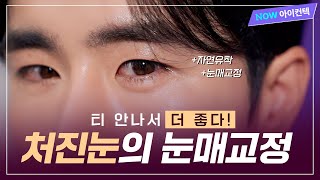 눈매교정으로 티 안나게 이미지 변신 성공✨ㅣ아이컨텍성형외과ㅣ남자눈성형ㅣ자연유착눈매교정