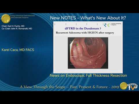 News on Endoscopic Full Thickness Resection