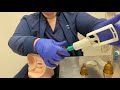 Penile Traction Stretching After Xiaflex