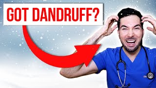 How to get rid of dandruff permanently at home and treatment